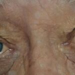 Need for care: Many people in need of care pay too much out of their own pocket