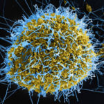 Ebola outbreak: It is time to stand guard at our borders